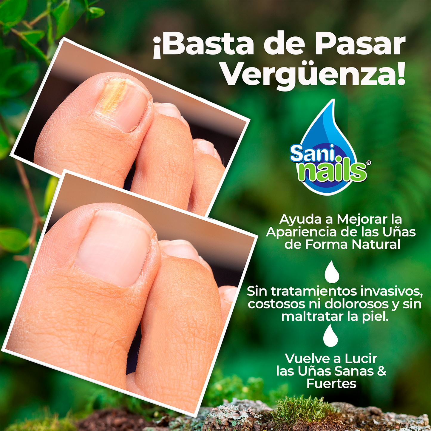 SaniNails Ayuda a Combatir Hongos Uñas