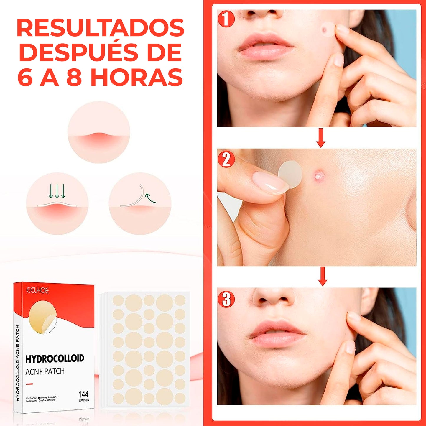 PARCHES ANTI IMPERFECCIONES 30 pcs
