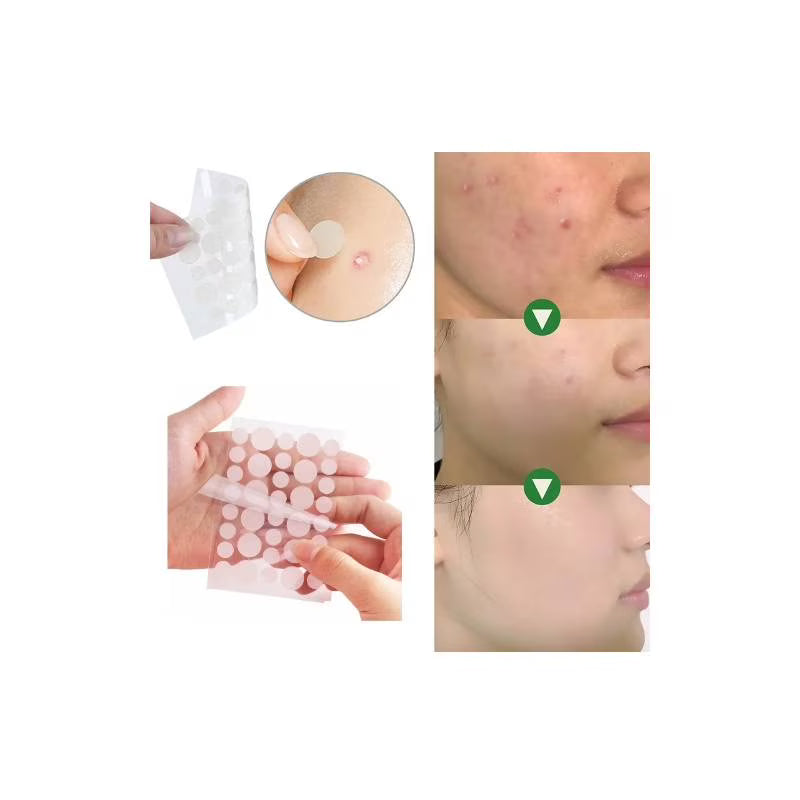 PARCHES ANTI IMPERFECCIONES 30 pcs